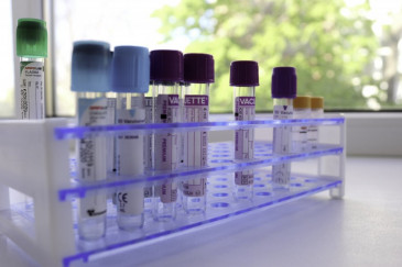 Несколько пробирок в стойке на столе